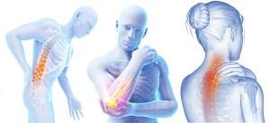 Fibrocare fibromialgia Sicilia