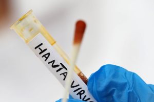test Hantavirus Sicilia